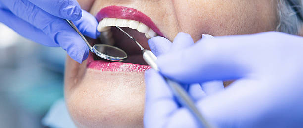 Best Emergency Dental Care for Abscessed Tooth in Mineral Ridge, OH